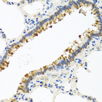 Anti-Cystatin-S Polyclonal Antibody (CAB8114)