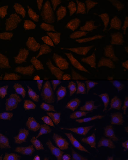 Anti-OAS3 Polyclonal Antibody (CAB9481)