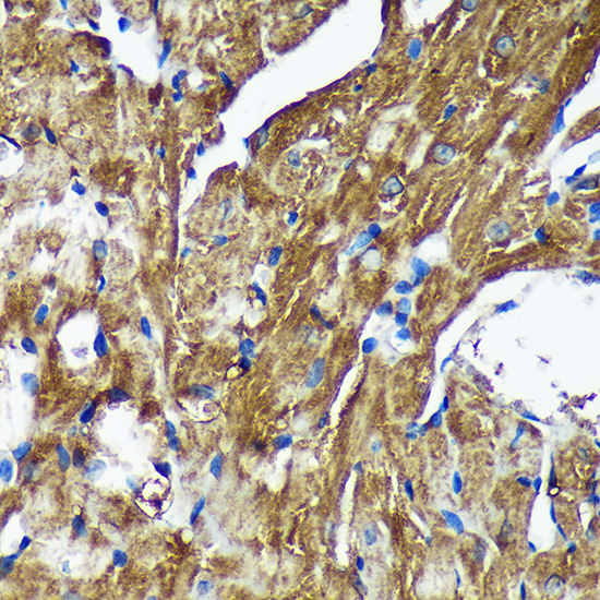 Anti-NSDHL Antibody [KO Validated] (CAB16893)