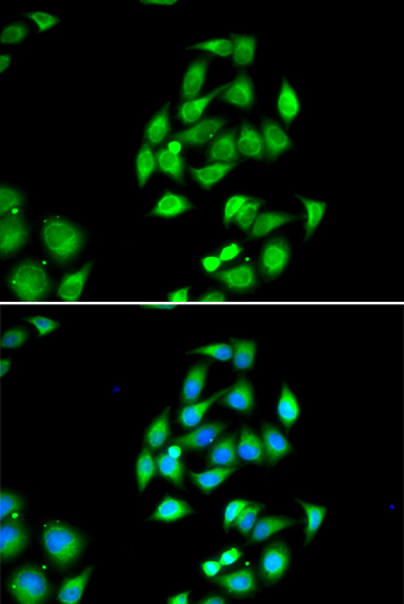 Anti-NFS1 Antibody (CAB13385)