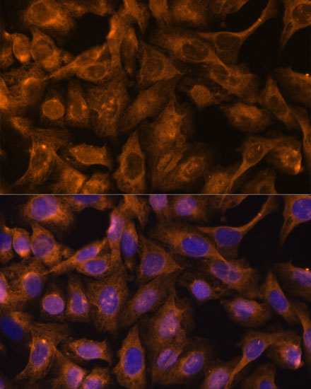 Anti-SEPT5 Antibody (CAB12953)