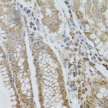 Anti-SELP Antibody (CAB1425)