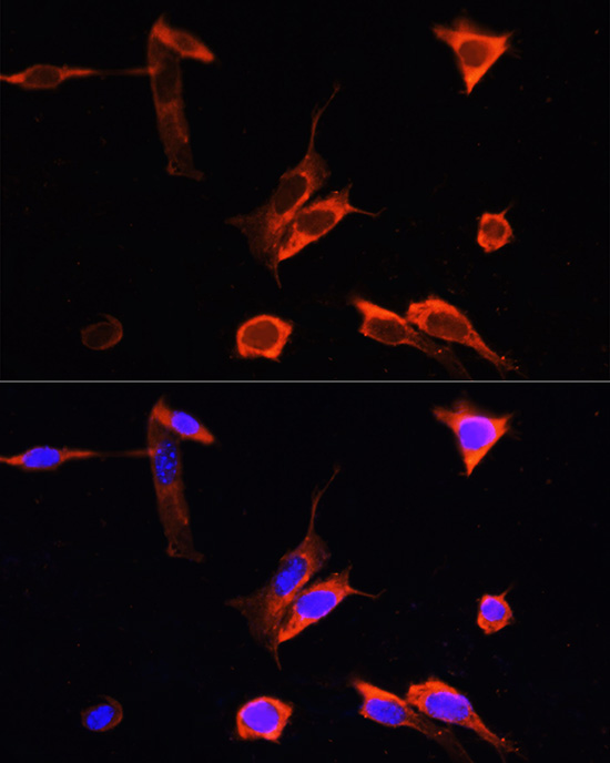 Anti-PINK1 Antibody (CAB7131)