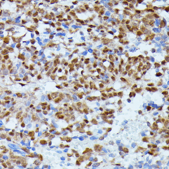 Anti-ID2 Antibody (CAB0996)