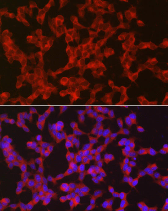 Immunofluorescence analysis of SH-SY5Y cells using Ret Rabbit pAb at dilution of 1:50 (40x lens). Blue: DAPI for nuclear staining.