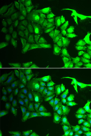 Anti-AIPL1 Antibody (CAB6458)