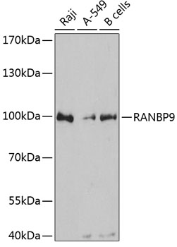 Anti-RANBP9 Antibody (CAB12097)