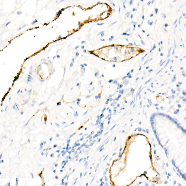 Immunohistochemistry of paraffin-embedded human colon using von Willebrand factor (VWF) antibody at dilution of 1:800 (40x lens). Perform high pressure antigen retrieval with 10 mM citrate buffer pH 6. 0 before commencing with IHC staining protocol.