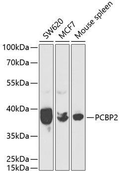 Anti-PCBP2 Antibody (CAB2531)