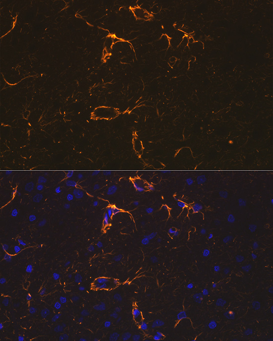 Anti-GFAP Antibody (CAB0237)