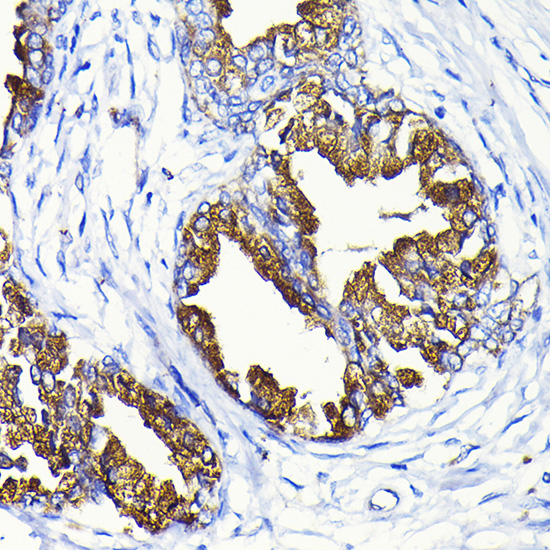 Anti-KLK3 Antibody (CAB2052)