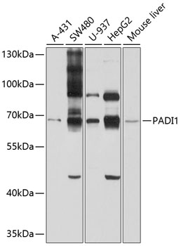 Anti-PADI1 Antibody (CAB10145)