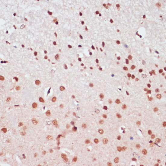 Anti-CREB1 Antibody (CAB11989)