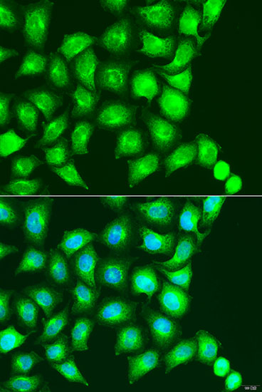 Anti-UBIAD1 Antibody (CAB7640)