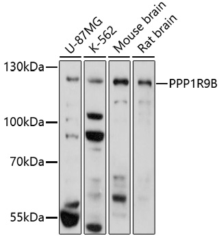 Anti-PPP1R9B Antibody (CAB17229)