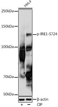 Anti-Phospho-IRE1-S724 Antibody (CABP1146)