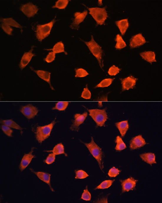 Anti-PFDN5 Antibody (CAB4014)