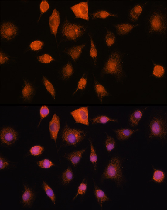 Anti-RNH1 Antibody (CAB4079)