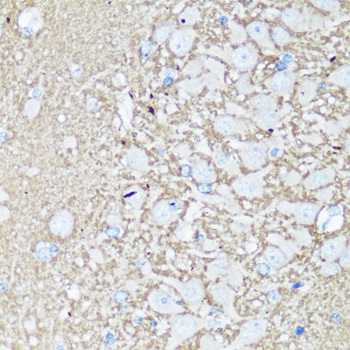 Anti-VAMP2 Antibody (CAB1249)