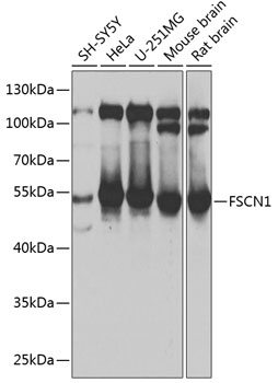 Anti-FSCN1 Antibody (CAB13355)