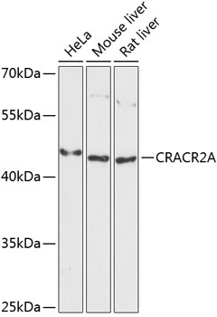 Anti-CRACR2A Antibody (CAB13839)