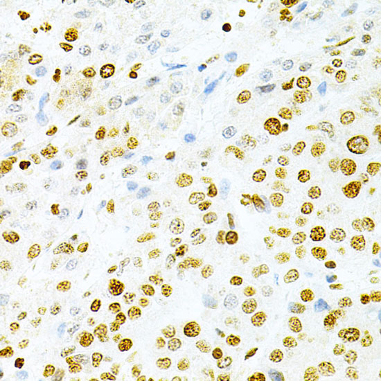 Anti-DKC1 Antibody (CAB1862)