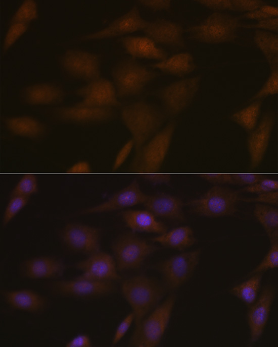 Anti-ASC / TMS1 Antibody (CAB16672)