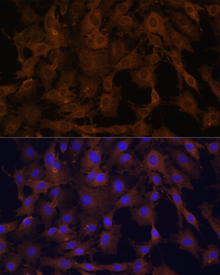 Anti-Bid Antibody (CAB0210)