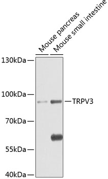 Anti-TRPV3 Polyclonal Antibody (CAB8598)