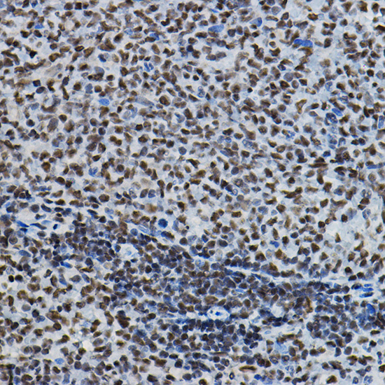 Anti-METTL14 Polyclonal Antibody (CAB8530)