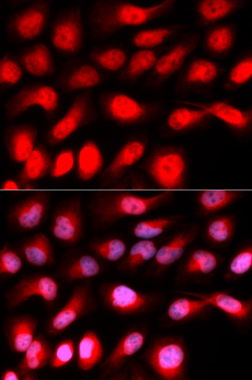 Anti-ZEB1 Antibody (CAB5600)