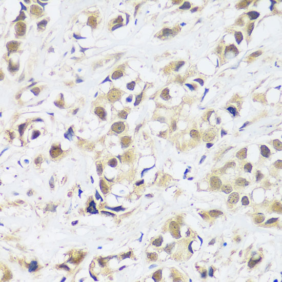 Anti-ASCL4 Antibody (CAB14439)