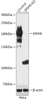 Anti-MSH6 Antibody [KO Validated] (CAB18007)