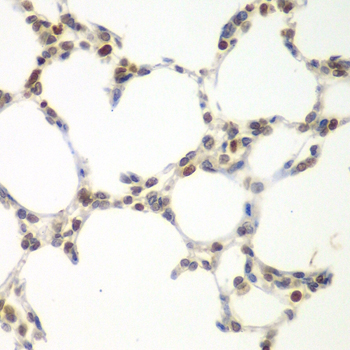 Anti-VRK1 Antibody (CAB7745)