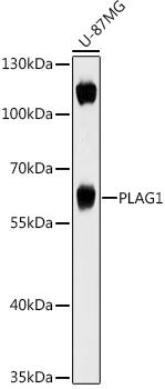 Western blot analysis of extracts of U-87MG cells, using PLAG1 antibody at 1:1000 dilution. Secondary antibody: HRP Goat Anti-Rabbit IgG (H+L) at 1:10000 dilution. Lysates/proteins: 25ug per lane. Blocking buffer: 3% nonfat dry milk in TBST. Detection: ECL Basic Kit. Exposure time: 60s.