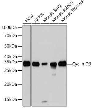 Anti-Cyclin D3 Antibody (CAB3989)