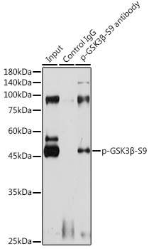 Anti-Phospho-GSK3B-S9 Antibody (CABP0039)