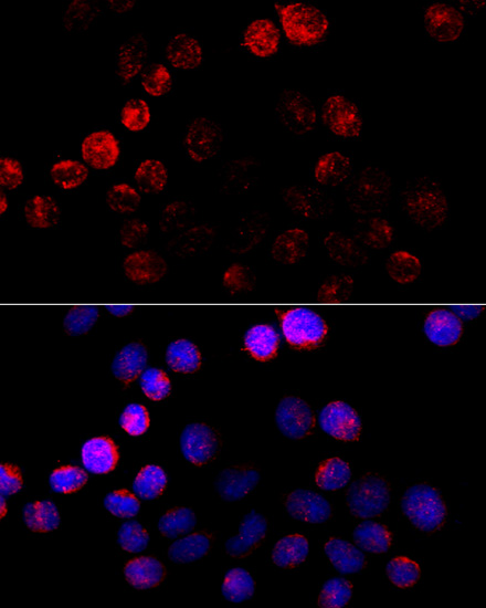 Anti-Aromatase Antibody (CAB12684)