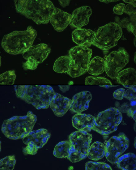 Anti-KRT13 Antibody (CAB16393)