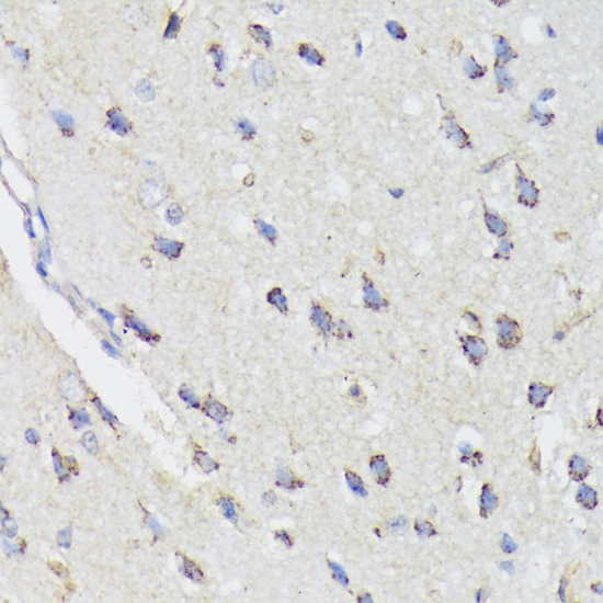 Anti-STAT3 Antibody (CAB11216)