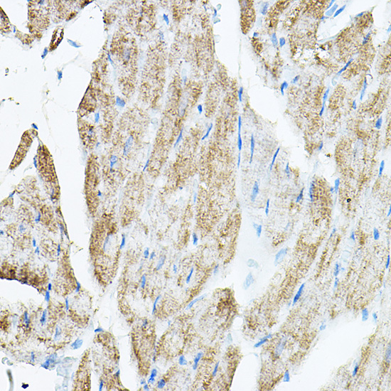 Anti-VEGFB Antibody (CAB17001)