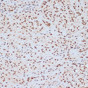 Anti-Phospho-MAPK3-Y204 Antibody (CABP0235)