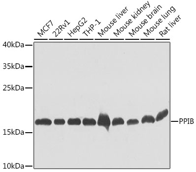 Anti-PPIB Antibody (CAB7713)