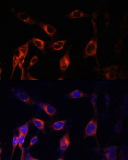 Anti-TSC1 Antibody (CAB0720)