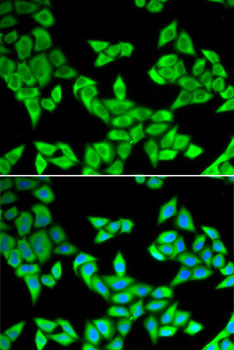 Anti-CIAPIN1 Antibody (CAB6336)