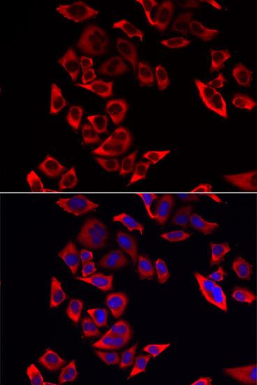 Anti-RPL9 Antibody (CAB13632)