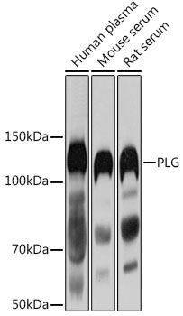 Anti-PLG Antibody (CAB3320)