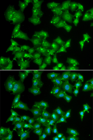 Anti-ELF3 Antibody (CAB6371)