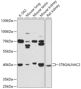 Anti-ST6GALNAC2 Antibody (CAB17618)