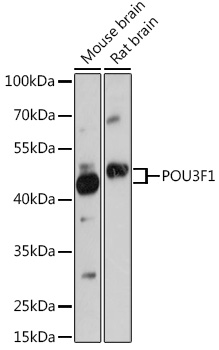 Anti-POU3F1 Antibody (CAB19330)